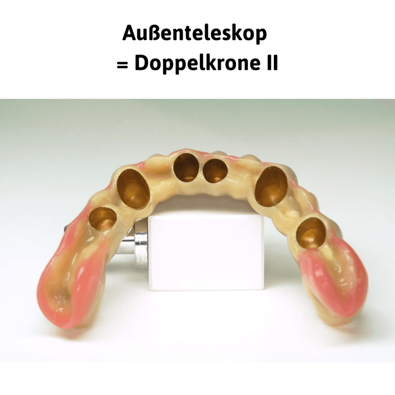Außenteleskop = Doppelkrone II